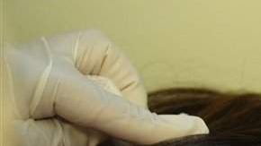 Una combinación de botox y terapia celular brinda buenos resultados.