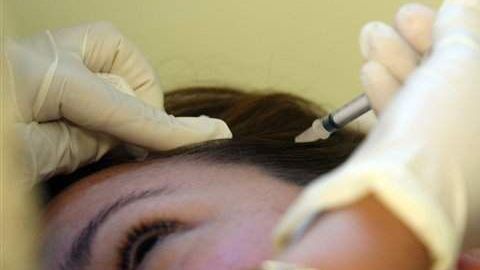 Una combinación de botox y terapia celular brinda buenos resultados.