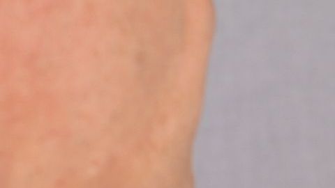 Dicho malestar lo tuvo una joven italiana que dio positivo a covid-19.