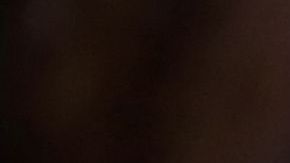 papada gorda obesidad