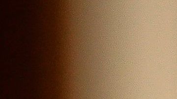 Hombres jóvenes, en su mayoría obesos, son quienes presentaron una inflamación del páncreas.