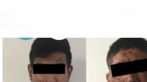 Suman 19 detenidos por el atentado.