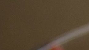 E. Coli puede causar deshidratación, diarrea y dolores abdominales.