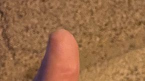 Heridas por las pelotas de goma que lanzan los policías a los manifestantes.