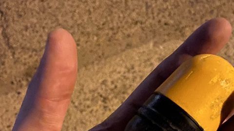 Heridas por las pelotas de goma que lanzan los policías a los manifestantes.