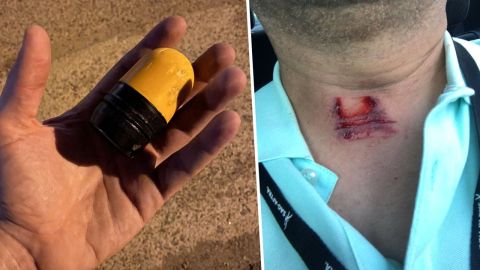 Heridas por las pelotas de goma que lanzan los policías a los manifestantes.