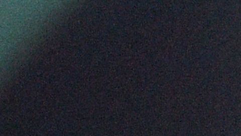 pulmones radiografía