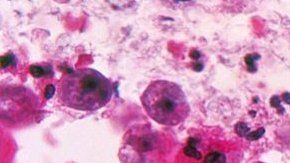 113253534_0f42b425-d0e6-4932-a90b-9c2dd5932233