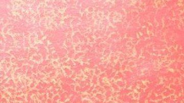 Reem Khougli y Issam Abdulraheem enfrentaron abusos raciales después de casarse.