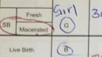 Registros de algunas de las muertes ocurridas en la maternidad del Hospital Central de Harare.