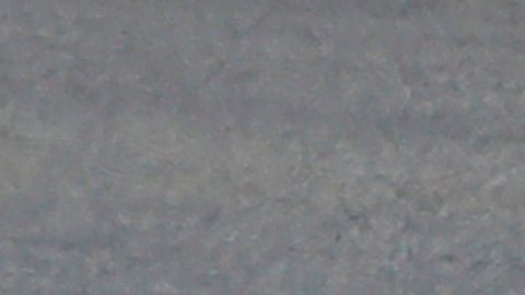 Marc Márquez será operado en Barcelona.