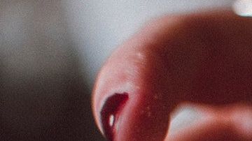 Foto: Lisa Fotios/Pexels