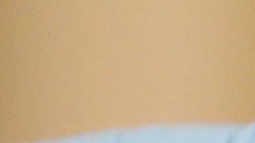 Redes sociales retiran video falso que aseguraba que la hidroxicloroquina cura el COVID-19