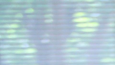 Un paciente es tratadio por coronavirus en California.