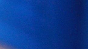 Productos para tratar las quemaduras leves.