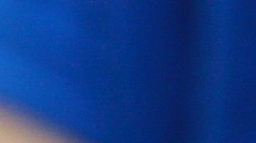 Productos para tratar las quemaduras leves.