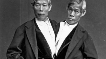 Los hermanos Chang y Eng Bunker