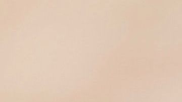 Solo uno de cada 100,000 recién nacidos nacen con esta condición.