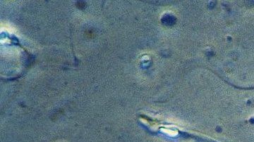 La interpretación del aleteo de los espermatozoides estaba basado en imágenes en dos dimensiones.