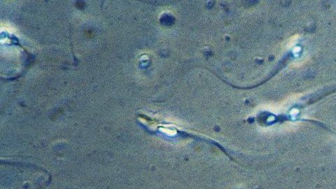 La interpretación del aleteo de los espermatozoides estaba basado en imágenes en dos dimensiones.