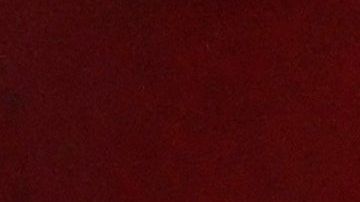 Ter Stegen fue intervenido de manera exitosa.