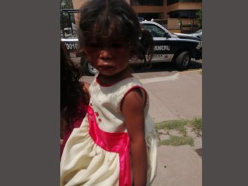 FOTOS: Niña de dos años es golpeada brutalmente por la pareja de su mamá