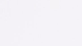 Así lucen las piedras o cálculos biliares de tipo pigmentado,