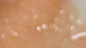 Refrigerar disminuye pero no detiene el crecimiento de bacterias en descomposición.