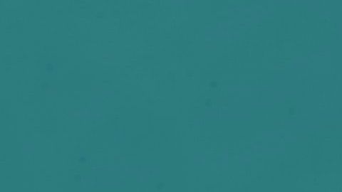 El trabajo le llevó a tener desórdenes alimenticios.