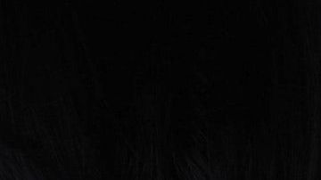 La piel es elástica y tiene la capacidad de recuperarse