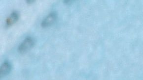 Los funcionarios de salud enviaron una alerta que describe una serie de estrategias para reducir la propagación.