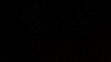 amalgama dientes odontología