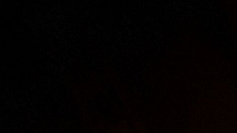 amalgama dientes odontología