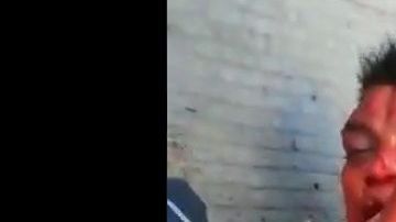 El sujeto recibió una fuerte golpiza.