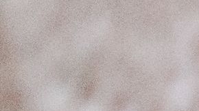 El niño tuvo un terrible accidente con una pesada mesa de granito.