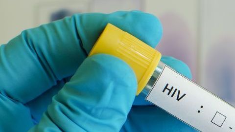 Una prueba positiva de VIH.