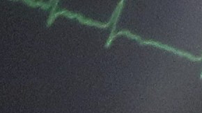 Los funcionarios de salud dicen que los casos de positividad del virus han disminuido en Chicago. Foto Impremedia