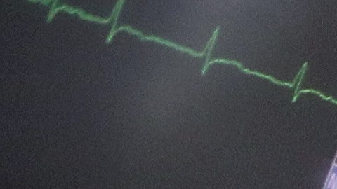 Los funcionarios de salud dicen que los casos de positividad del virus han disminuido en Chicago. Foto Impremedia