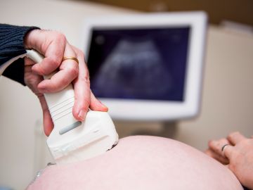 Médico realiza un examen de ultrasonido durante la visita de una mujer embarazada.