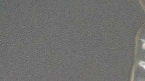 Los miembros del personal médico trabajan para instalar un circuito de ventilador en la garganta de un paciente por COVID-19 en una unidad de cuidados intensivos.