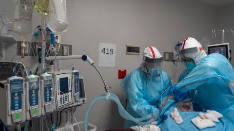 Los miembros del personal médico trabajan para instalar un circuito de ventilador en la garganta de un paciente por COVID-19 en una unidad de cuidados intensivos.