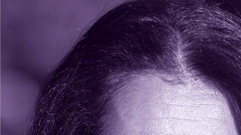 Se estima que unos  30 millones de estadounidenses sufren una enfermedad rara.