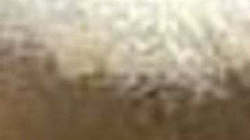 Isayah, de nueve años, nació con una enfermedad genética que causa insuficiencia renal.