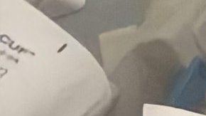 La inmigrante mexicana Elisa Andrade de 54 años que padece de cirrosis hepática recibe atención médica en el Hospital Stroger de Chicago. (Cortesía Yesenia Pérez)