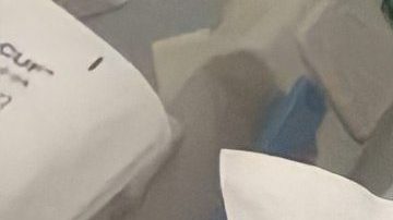 La inmigrante mexicana Elisa Andrade de 54 años que padece de cirrosis hepática recibe atención médica en el Hospital Stroger de Chicago. (Cortesía Yesenia Pérez)