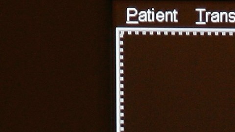 Imágenes digitales de un estudio de mamografía, técnica usada para detectar cáncer de mama.