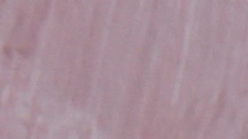 Las campañas de concientización sobre el cáncer de seno tienen alcance internacional.