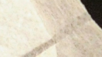 Una muestra de fluido humano de una persona diagnosticada con meningitis.