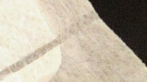 Una muestra de fluido humano de una persona diagnosticada con meningitis.