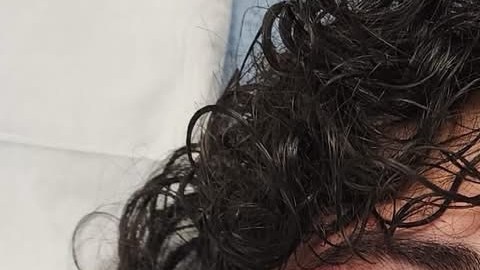 El joven “J.R.” muestra las lesiones en su rostro que, alega una demanda, sufrió a manos de policías de Rockford, IL. (Cortesía Loevy+Loevy)